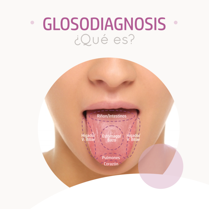 diagnostico de lengua mtc